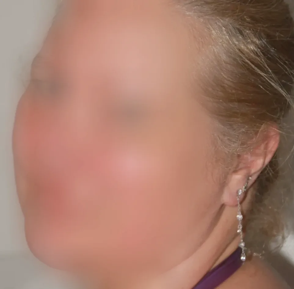 Cara, 28
